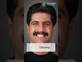 #ToothJourney #toothloss Tired of hiding your smile or struggling with loose teeth?