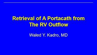 Retrieval of an embolized central catheter from the RVOT and the PA trunk.