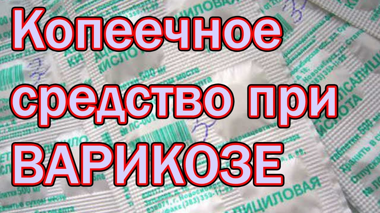 Как Избавиться от Варикоза Шпор и Остеохондроза [Народный способ ...