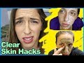 Clear Skin Hacks!