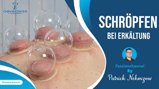 Tipps Gegen Erkältungen Schröpfen Um Die Selbstheilungskräfte Zu Aktivieren.
