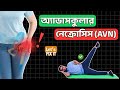 অ্যাভাসকুলার নেক্রোসিস (AVN) হলে (5) নিরাপদ ব্যায়াম ! Hip Joint Pain &amp; AVN Exercise Bangla