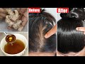 I tried this-Hair Transforming Ginger Hair Oil-Got Double Hair Growth in 1 Month-Apply only on Scalp