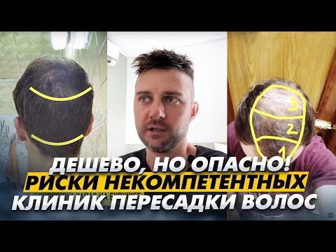 Как не попасть