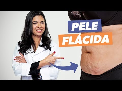 Vídeo: Como Remover Uma Barriga Flácida