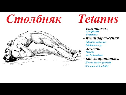 Video: Tetanus - Tetanus U Detí, Príznaky A Liečba