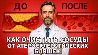 Как очистить сосуды от атеросклеротических бляшек: что действительно помогает