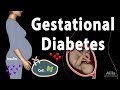 Gestational Diabetes, Animation