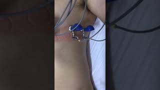 Posições dos eletrodos pré-cordiais de ECG Posições dos eletrodos pré-cordiais de ECG