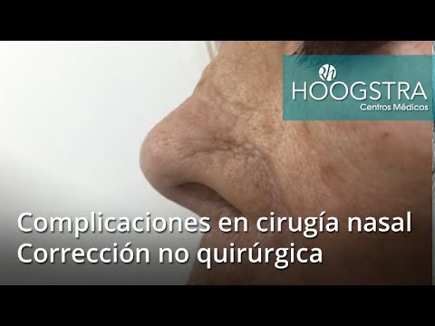 Cuanto cuesta la cirugia de nariz