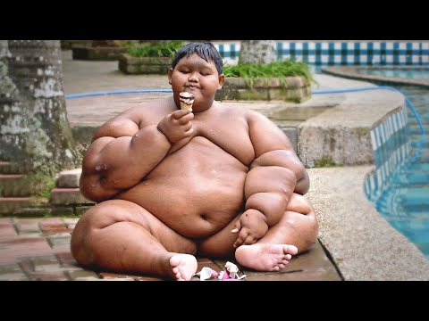 Vídeo: A Criança Mais Gorda Do Mundo Perdeu Metade De Seu Peso - Visão Alternativa