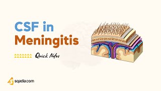 Csf In Meningitis Introduction Symptoms, Pathogenesis, Microbiology Infectious Medicine