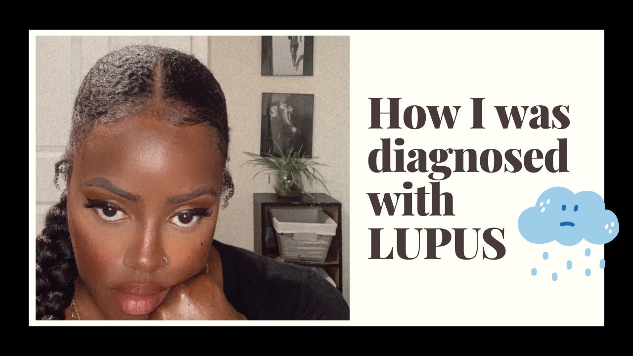 My Lupus Story/ My symptoms/ My treatment/
