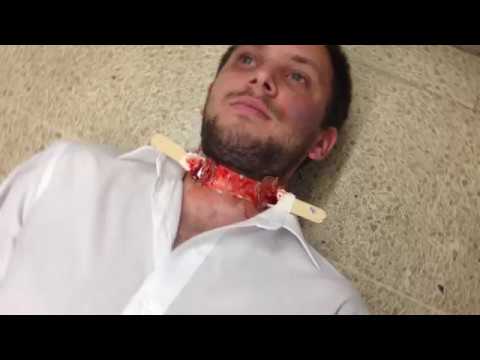 Moulage como técnica de enseñanza y evaluación en pregrado. content media