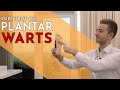 Treating Plantar Warts - Lewis Nurney, Singapore Podiatrist