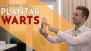 Plantar Warts Explained - Lewis Nurney, Singapore Podiatrist