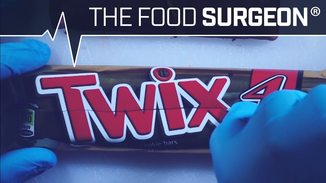 Butterfinger Fracture Repair with Twix Splint