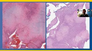 Bone Cases - case 3 answer screenshot 2