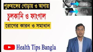 অন্ডকোষ ও পেনিসের চুলকানি থেকে মুক্তির উপায় health tips bangla
