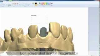 Dental System™ 2012  3Shape Communicate™