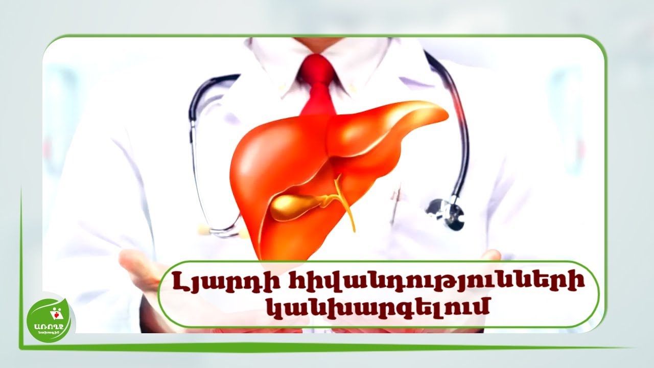 Լյարդի հիվանդությունների կանխարգելման հիմքում առողջ կենսակերպն է - #Առողջնախագիծ