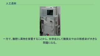 人工透析