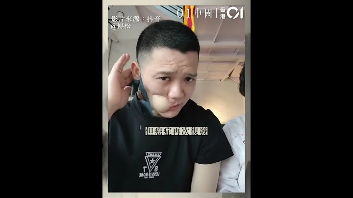 36岁歌手傅松患口腔癌病逝　曾嚼槟榔6年需做手术切除左脸 - 天天要闻