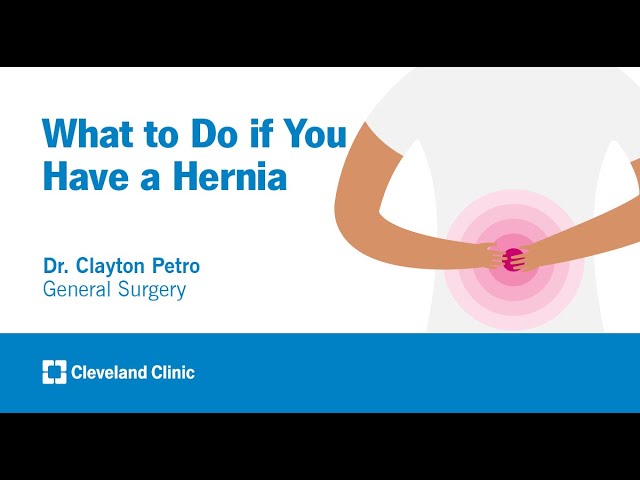 What to Do if You Have a Hernia