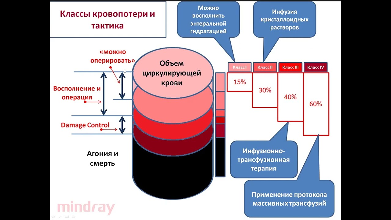 Инфузионно-трансфузион терапия травм шока Афончиков В.С. 2023