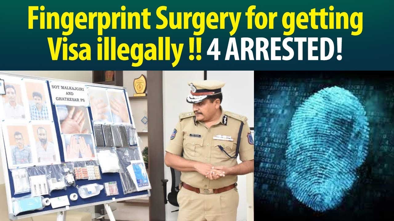 Telangana cops bust Fingerprint surgery racket…Operation done in