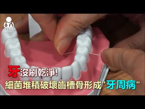 台中榮總-吃東西牙齒沒力、痠軟！可能中重度牙周病了！！