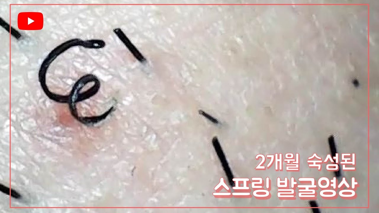 New 2개월 숙성된 스프링 발굴영상