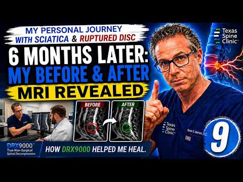 My DRX 9000 Spinal Decompression Experience: Does It Really Work?