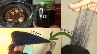Do Not wash it out! Use this OIL everyday on Your scalp to fight alopecia &amp; stop hair loss very fast