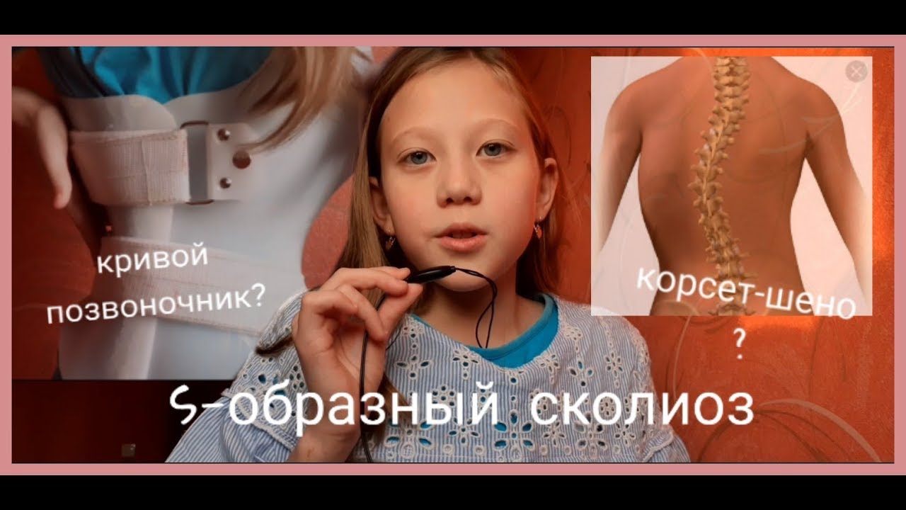 Моё первое видео💫 | s-образный сколиоз,что это такое? - YouTube