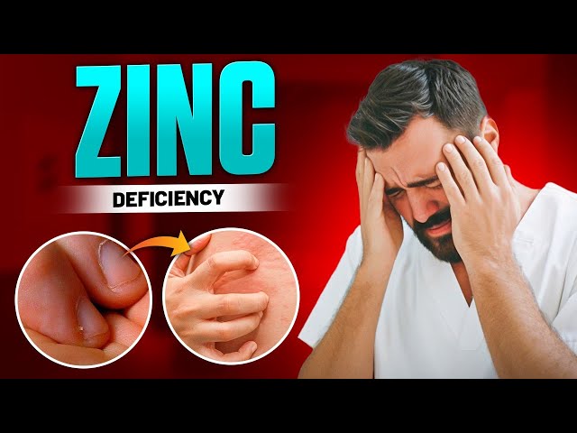 Zinc deficiency symptoms | White Nails | Hair Loss | Skin Lesions | Low  Immunity - YouTube