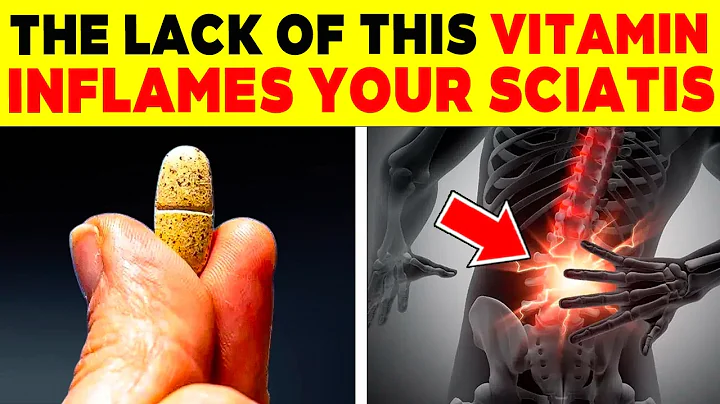 ALERT! 15 MUST-HAVE VITAMINS for SCIATICA or sciatic nerve pain | 131