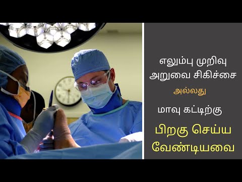 எலும்பு முறிவு சிகிச்சைக்கு பிறகு நான் எப்படி இருக்க வேண்டும்?  கேள்விகளுக்கு பதில்-Dr. Kunal Dheep