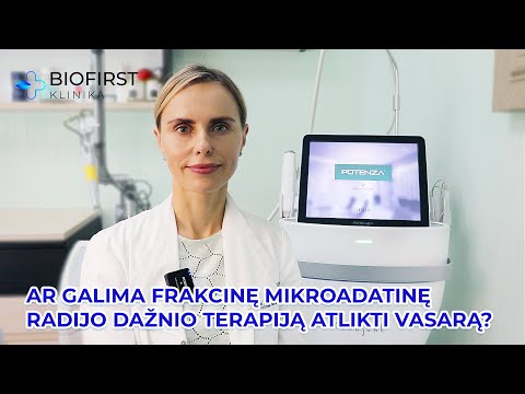 Video: Ar galite atlikti pirografiją patalpose?