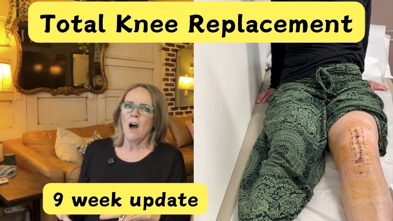 Операция по полной замене коленного сустава — обзор за 9 недель