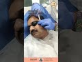 Acne Scar Revision Treatment | Eliixir Skin &amp; Hair Clinic | Dr Shikhar Chaube | #dermatologist