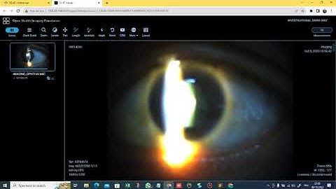 RIS PACS DICOM Web Viewer SIMRS