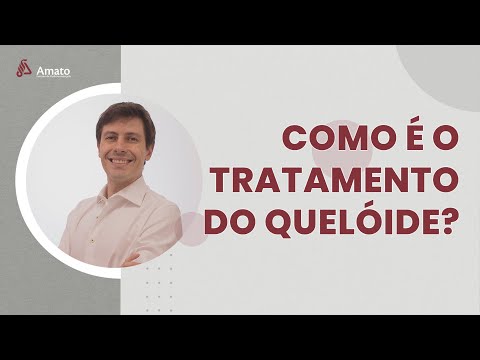 Como é o tratamento do Queloide?