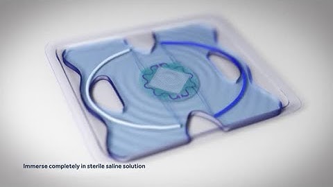 Parietexᵀᴹ Ventral Patch Animation