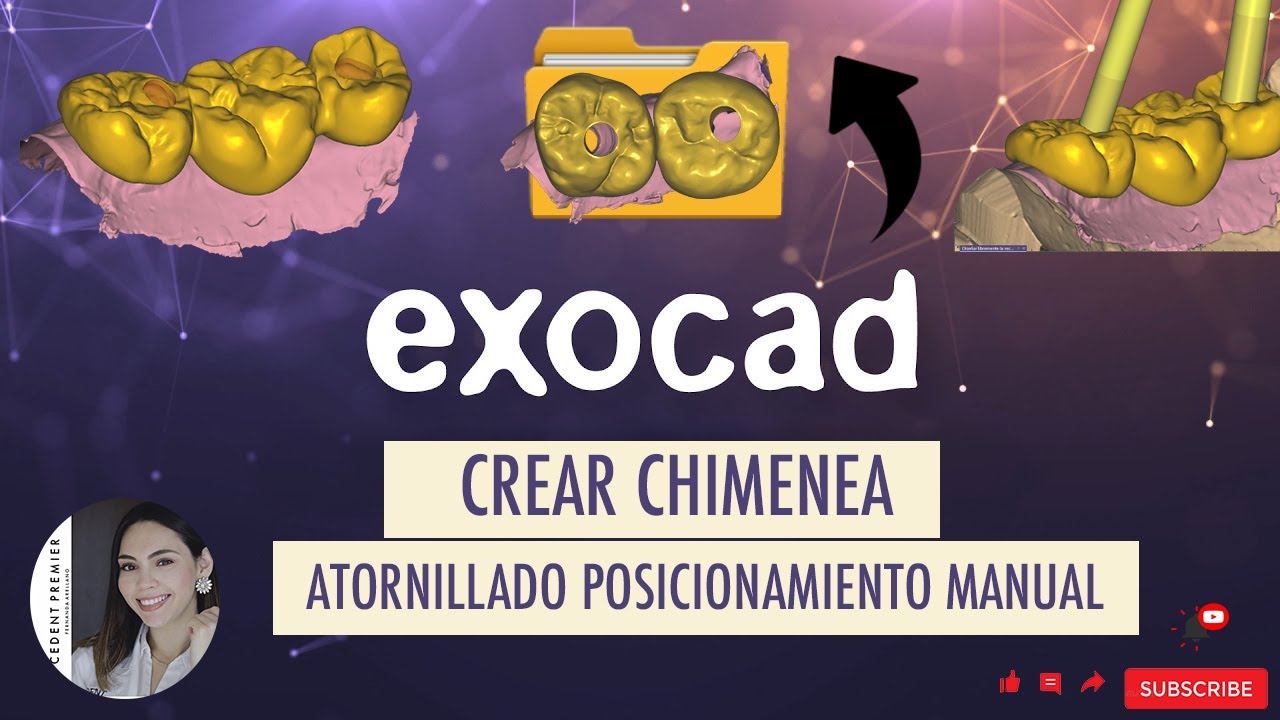 Cómo Crear Chimenea Atornillado Posicionamiento Manual- Exocad-Modulo de implantes.💥 🖥