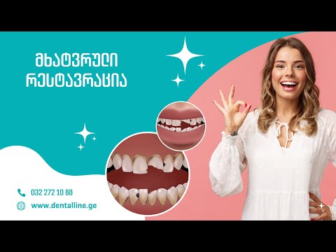 კბილების მხატვრული რესტავრაცია