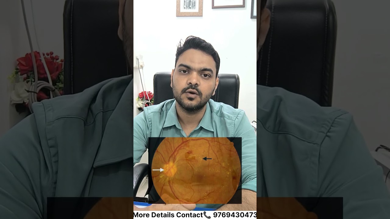Diabetic retinopathy kya hota hai ??#diabetesawareness #diabeticretinopathy #viralshots #eyecaretips