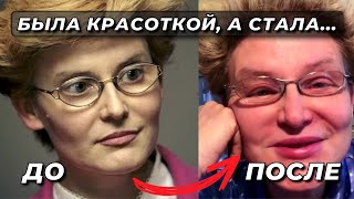 Узнали только по голосу. Какая болезнь оставила Елену Малышеву без лица?