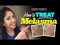 Doctor V - How To Treat Melasma | Skin Of Colour | Brown Or Black Skin