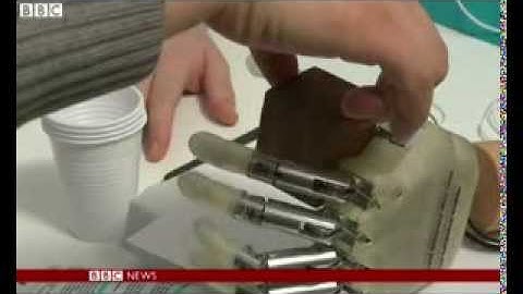 Revolutionary bionic hand allows amputee to feel again